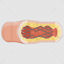 Restenosis vector scientific illustration