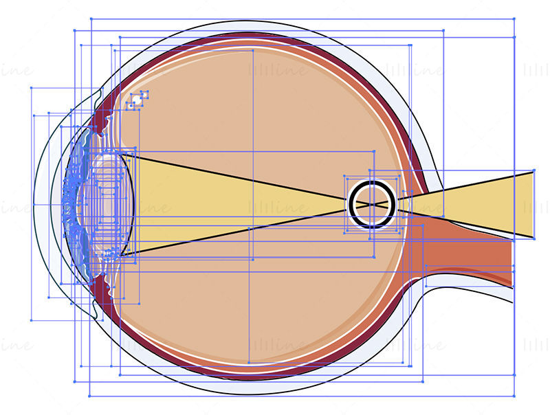 Ilustración de vector de ojo miope, Oftalmología