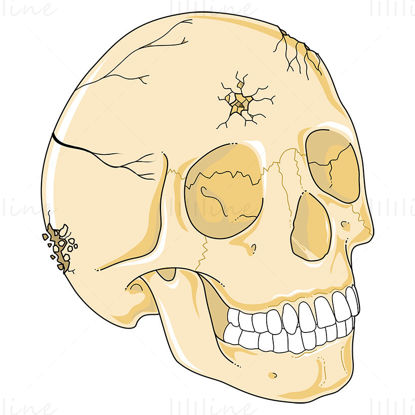 Skull fractures vector