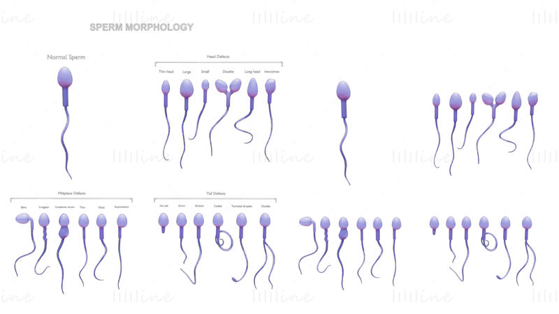 Sperm Morfologi 3D-modell: Normal og unormal