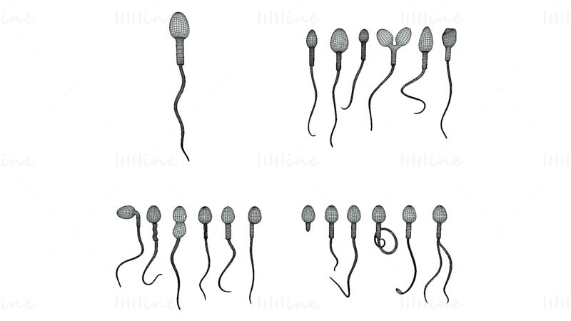 3D-Modell der Spermienmorphologie: Normal und abnormal