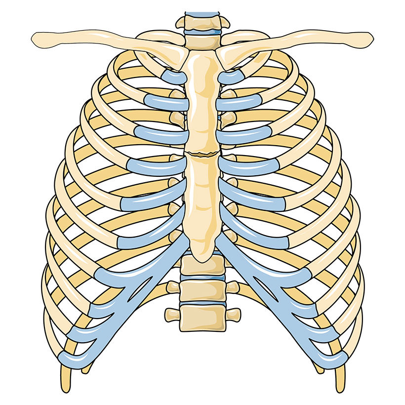 Sternal fracture vector