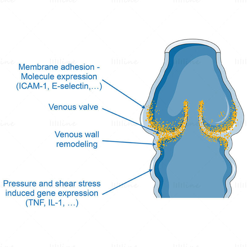 Varicose vein vector