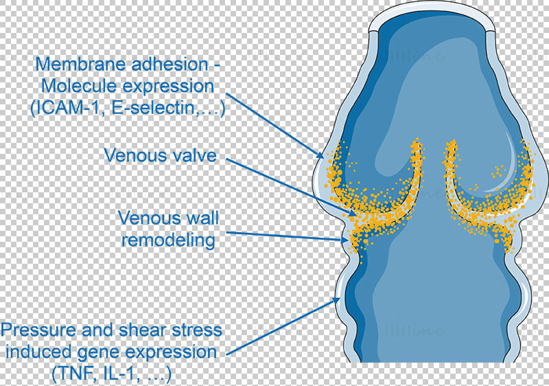 Vecteur de varices