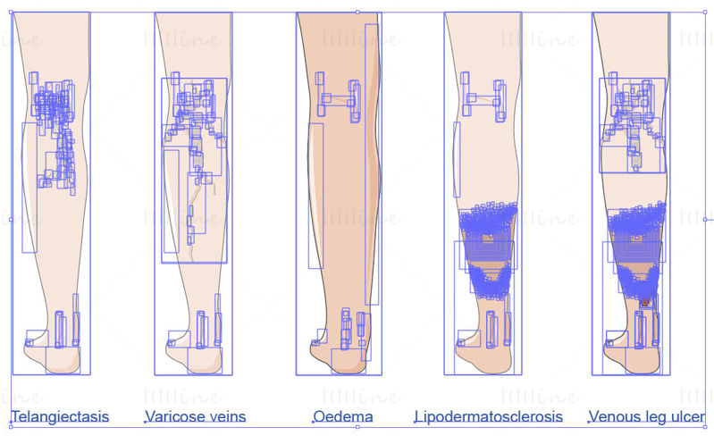 vector de enfermedad venosa