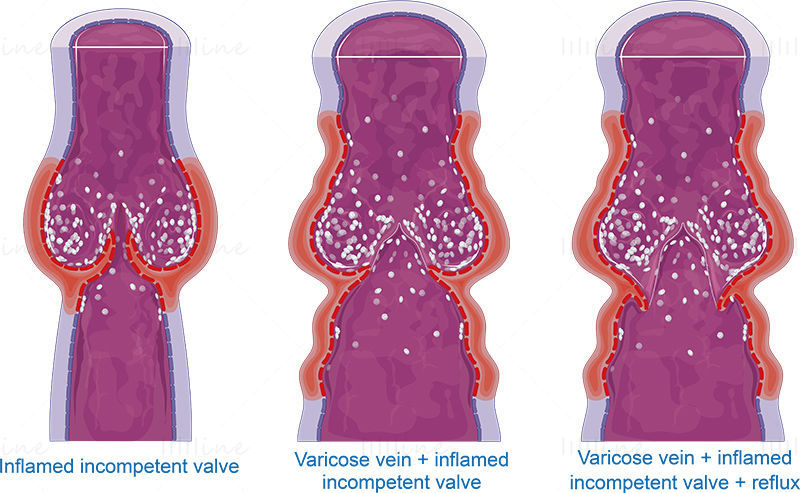 Venous valves vector